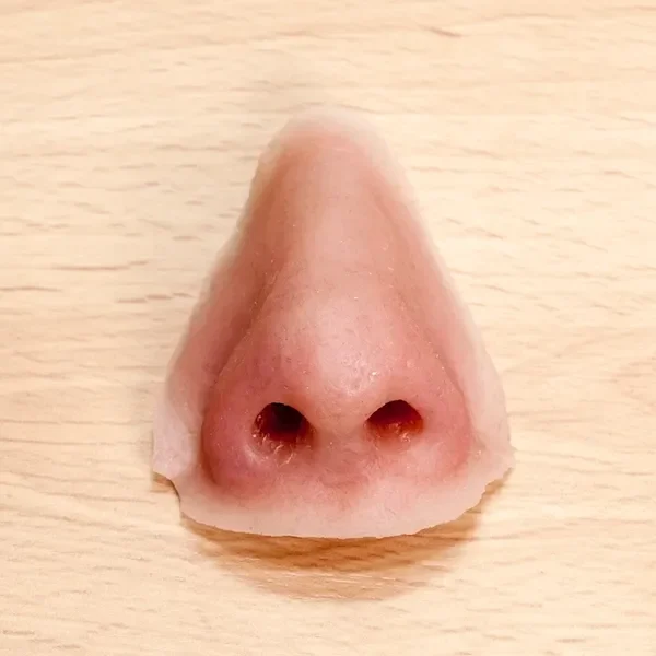 Custom nasal prosthesis available at SEE Prosthetics in Essex